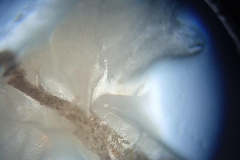 IMG_20230422_181255858_900x1200